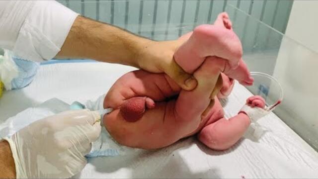 Baby Abdominal Pain Relief 💊 | Suppository Treatment in NICU👶  #AbdominalPain #SuppositoryRelief