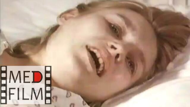 Обезболивание схваток при родах. Анальгезия © Pain during childbirth, Analgesia