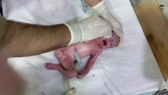 Neonatal Resuscitation | Emergency Care for Newborn 🆘👶 #viralvideo #babyresuscitation #nicuemergency