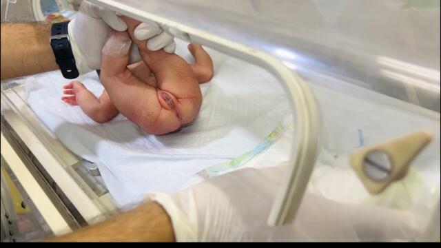 Step-by-Step Newborn Diaper Change – How to Clean Poop Properly 👶💩