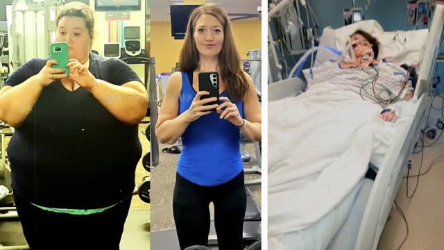 Fitness Influencer Nearly Dies After Open Wounds Become Necrotic