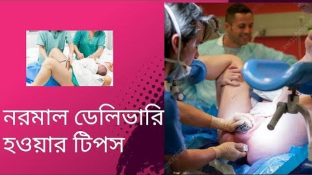নরমাল ডেলিভারি হওয়ার টিপস। নরমাল ডেলিভারি হওয়ার উপায়। নরমাল ডেলিভারির জন্য করণীয়। normal delivery.