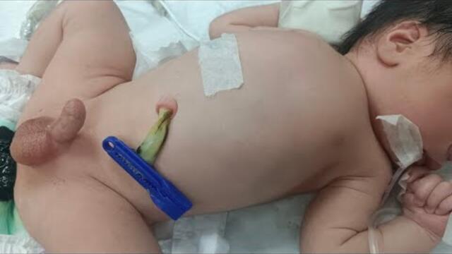 very cute new born baby 😱 #hospital #baby #newbornbaby #viralvideo