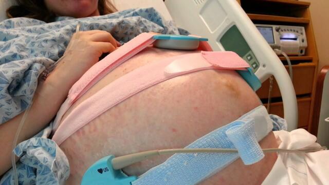 Twin fetal movement at 34 weeks (Noah and Bently)