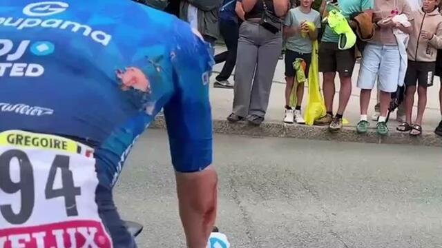 Romain Grégoire bien amoché après sa chute lors de la 20e étape du Tour de France 2025 - Cyclisme - Tour de France