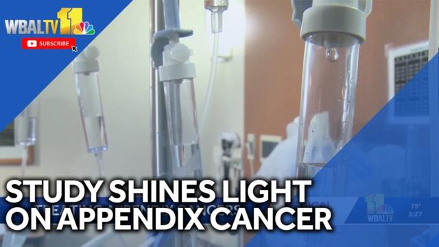 Study shines light on misdiagnosed appendix cancer