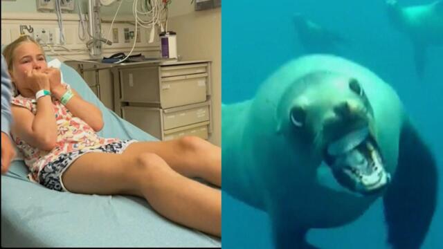 9-Year-Old Attacked by Sea Lion