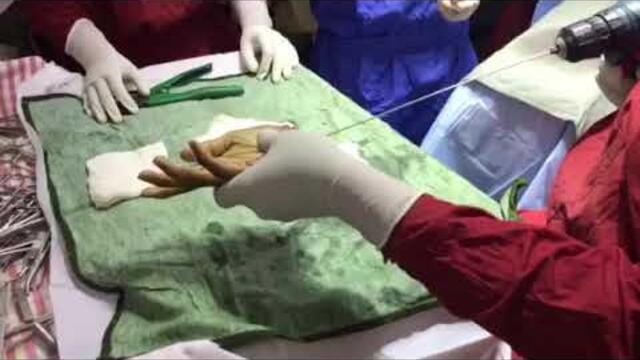 Hand surgery, microsurgery, vascular surgery, trauma, tendon surgery, nerve surgery