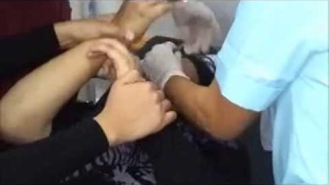 Colocacion de Sonda Nasogastrica VIDEO