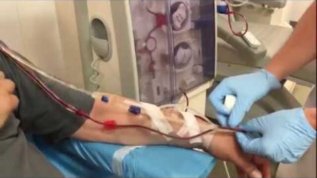 Dialysis, connection of a patient with an arteriovenous fistula