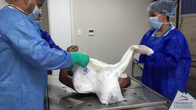 AUTOPSIA ASFIXIA POR SUMERSIÓN