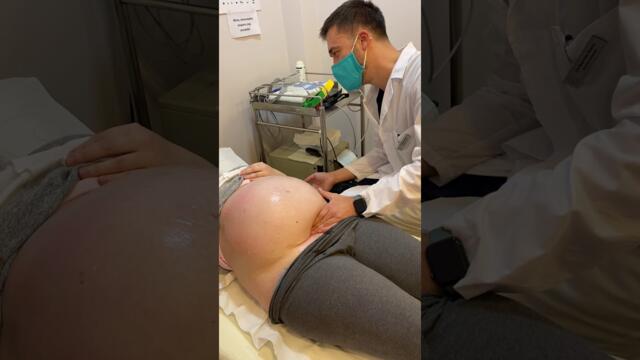 Външно верзио/external cephalic vesrsion/äußere Wendung