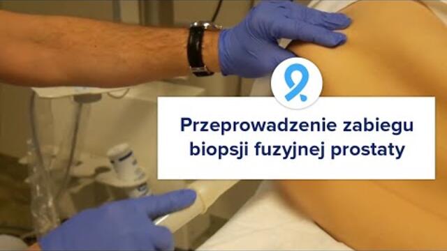 Przeprowadzenie zabiegu biopsji fuzyjnej prostaty - KOELIS TRINITY