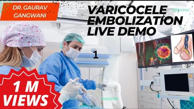 Live Varicocele Embolization Case 1| Non-surgical treatment of Varicocele | Dr. Gaurav Gangwani