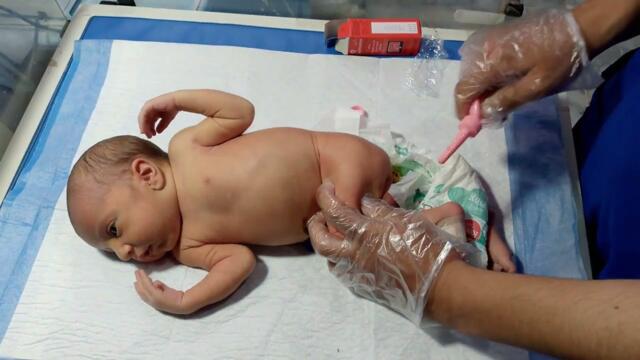 🤲💕Micronema pass for abdominal distension baby to relief abdominal pain 🤲💕