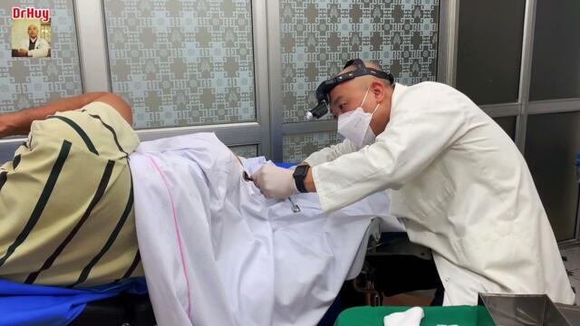 Tâm sự của bệnh nhân sau khi được tiêm thuốc teo búi trĩ ( Injecting medicine to shrink hemorrhoids)