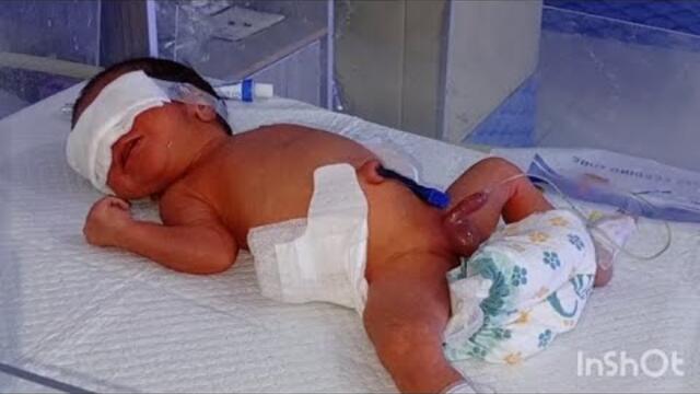 🩺💕❣️🥀🩺🍼  **"NICU Catheterization Mastery – Neonatal Procedures & Critical Care"**