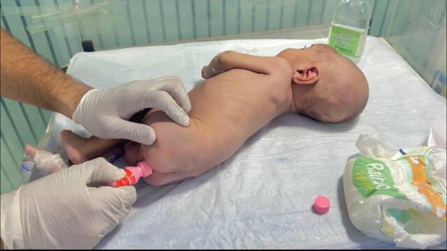 Newborn Constipation Relief: Pediatrician's Suppository Guide | first baby suppository