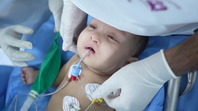 Anesthesia and Surgery | A Life-Saving Safe Surgery