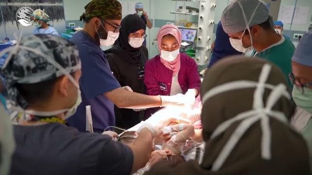 نجاح عملية فصل التوأم السوري “سيلين وإيلين”