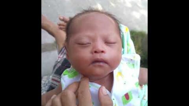 PERKEMBANGAN BAYI DOWN SYNDROME 0 - 3 BULAN || ARSAKA CHANEL