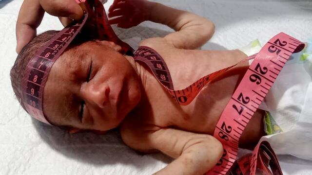 Newborn BabyAnthropometric Measurements | Head Circumference,Abdominal& Chest Circumference, Length