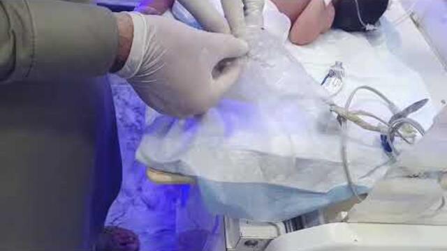 "How to Pass a Urinary Catheter in a Newborn Baby in the NICU | Step-by-Step Neonatal Care"