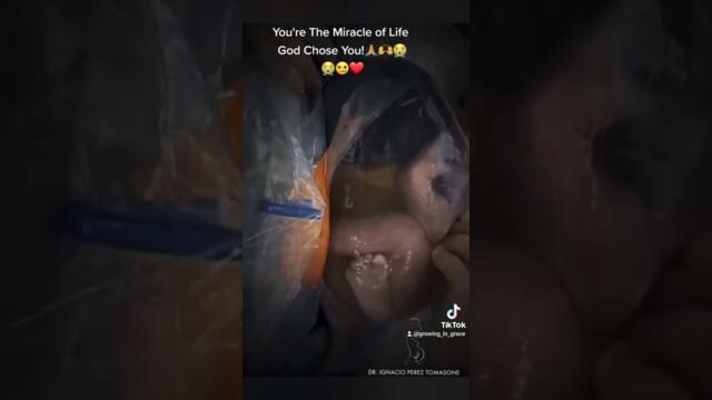 God Chose You! You're the Miracle of Life! #life #Miracle #motivational