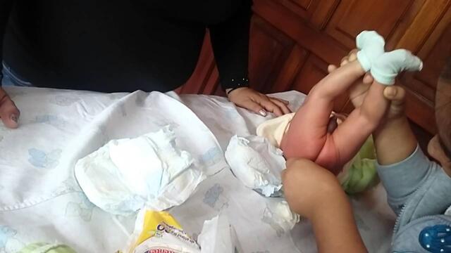 Revisando la pediatra a mi bb sobrinito