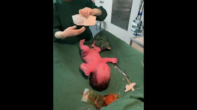#newborns #baby #pregnant women giving birth#multiple births#twin#新生儿