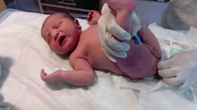 Gentle Management of Abdominal Distension 🍼||Educational & Awareness Video