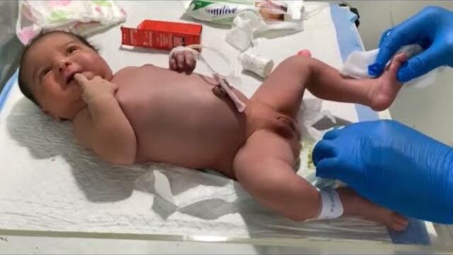 Newborn Baby Girl Abdominal Distension Relief 💨 | How to Safely Use a Suppository 👶❤️"