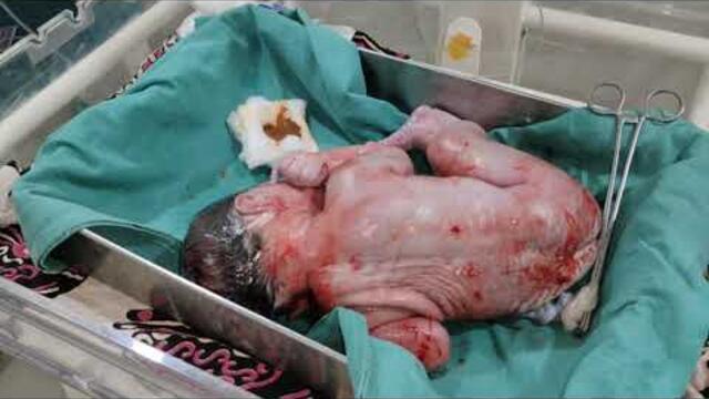Normal delivery || Birth baby 😀 #baby #trending #newbornbaby #beautiful #afterbirth #viral #babycare