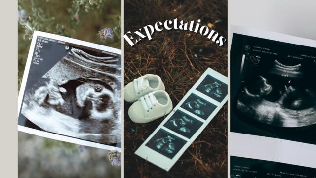 Бременност в 9 месец: Очаквания, избор на лекар, подготовка