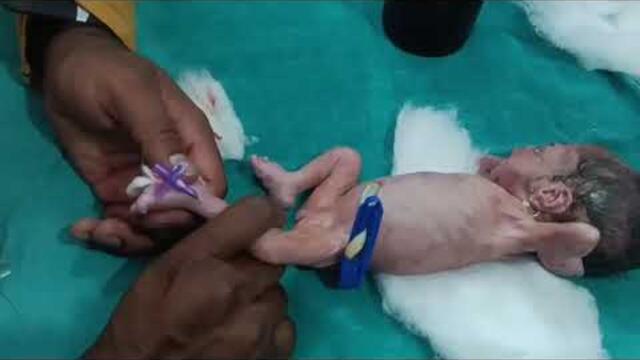 Dr #pediatrics #Jitendra #nicu #cute #baby #hospital my YouTube channel subscribe🙏🙏