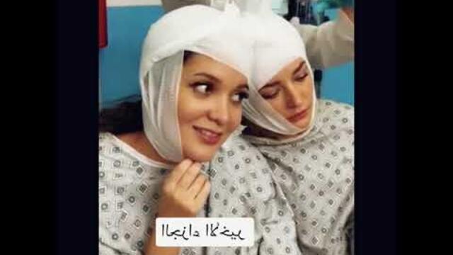 اكذوبه توأم ملتصق لأكثر من 25 سنة # طب # عملية # توأم ونهاية سعيدة🤔👏😱