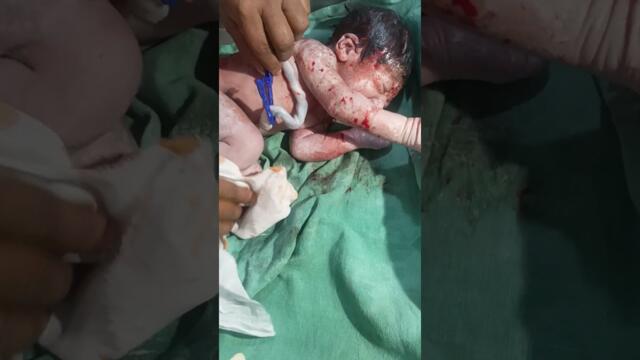 NICU CARE, baby born by C-section #support #baby #newbornbaby #cutebaby #youtubeshort #youtubeviral