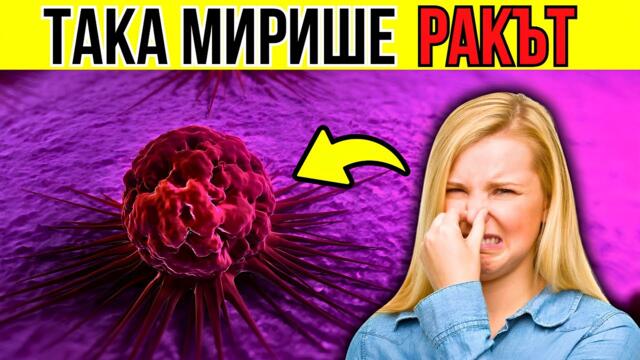 ВНИМАНИЕ! 5 МИРИЗМИ, които показват ПРИСЪСТВИЕ на РАК в ТВОЕТО ТЯЛО