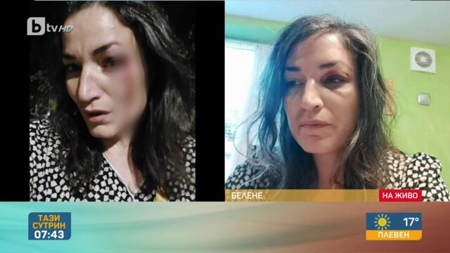 Жена бе нападната от мъж на улицата I „Тази сутрин“