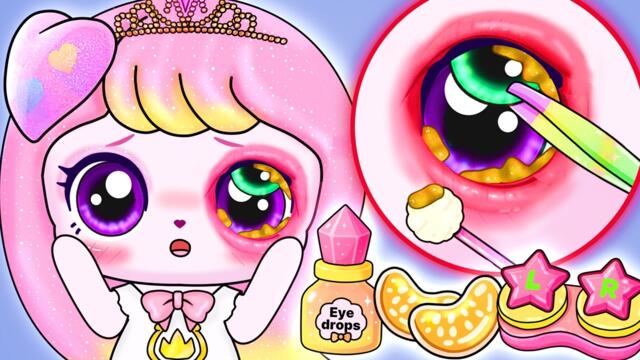 🌟Teenieping Claireping🌟 Contact Lens Irritation Treatment | ASMR animation