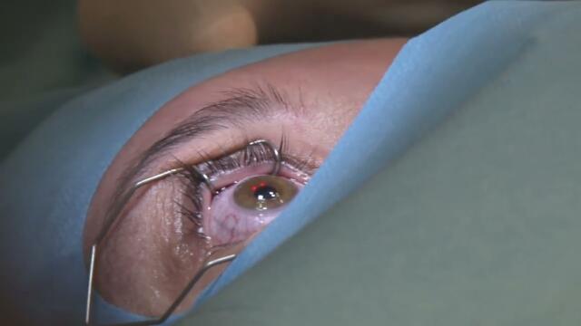 Трансляция коррекции зрения по технологии Femto Lasik в клинике премиум-класса КОРД