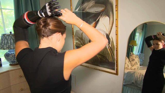 Teen Relearns How To Do Daily Tasks After Devastating Shark Attack