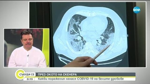 Пулмолог: Незабавно посетете специалист, ако проявите симптоми на остро заболяване