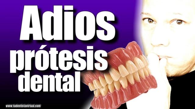 Como REEMPLAZAR TODOS los DIENTES aunque NO TENGAS mucho HUESO en las ENCÍAS y le TEMAS a la CIRUGÍA