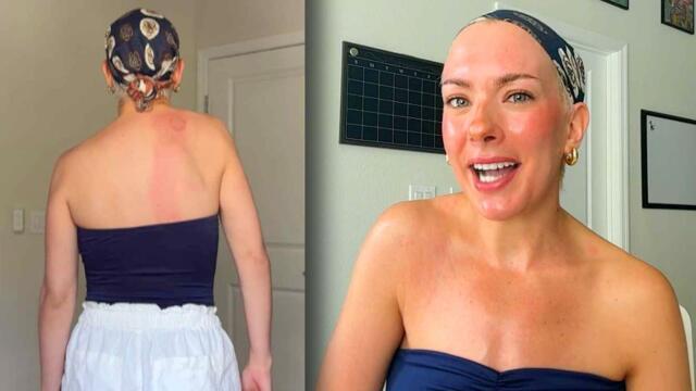 Woman Looks For Answers To Her Bizarre Medical Mystery