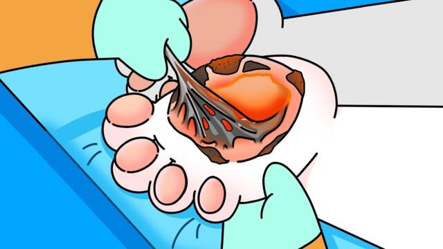 asmr split thickness skin for feet on asphalt animation | Dr. Higo cartoon