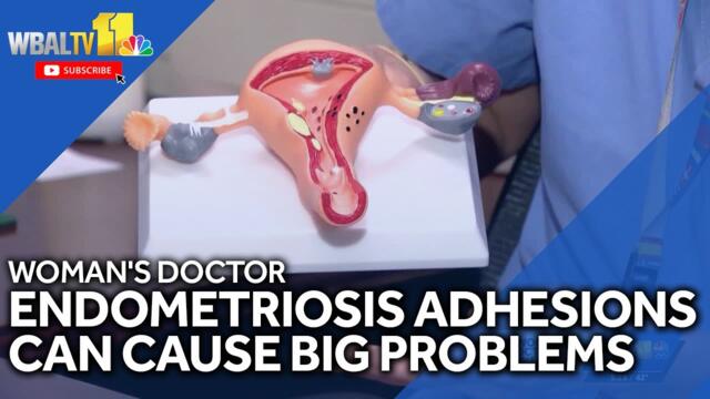 Endometriosis adhesions can cause big problems | Here's why