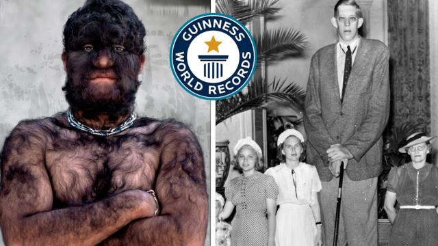 📷▶73 SHOCKING Real Human FREAKS That Actually Existed | Rare Photos That Remind Us of CIRCUS FREAKS