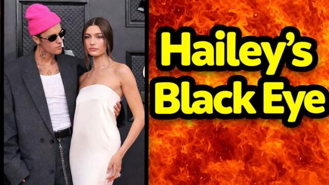 Hailey Bieber's Bruised Eye Brings Unwanted Heat To Justin