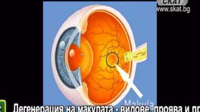 Академия Здравословно: Дегенерация на макулата - видове, проява и прогноза